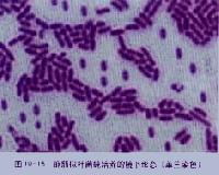 食品微生物檢驗 守護餐桌安全的關鍵技術